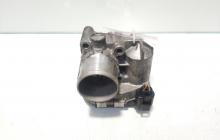 Clapeta acceleratie, cod 8200330810E, Renault Scenic 2, 2.0 DCI, M9RA700 (idi:395954)