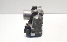 Clapeta acceleratie, cod 8200330810, Renault Megane 2, 2.0 DCI, M9R700 (idi:631596)