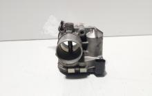 Clapeta acceleratie, cod 8200330810, Renault Megane 2 Combi, 2.0 DCI, M9R700 (idi:676179)
