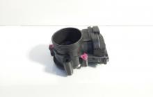 Clapeta acceleratie, cod V757669780, Peugeot 308, 1.6 benz, 5FW