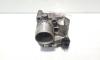 Clapeta acceleratie, cod 8200330810E, Renault Megane 2, 2.0 DCI, M9R700 (idi:395954)